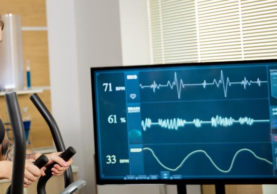 Programa de rehabilitación cardíaca con cardiólogo especializado, Dra Nieves Montoro, CEO de la clínica de cardiología en Madrid SAMON